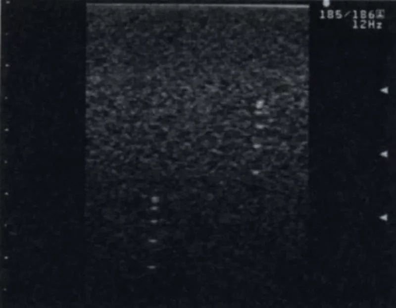 Erler-Zimmer Vielzweck-Phantom
