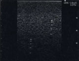 Erler-Zimmer Vielzweck-Phantom