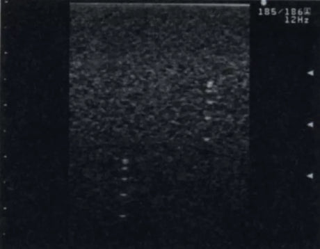 Erler-Zimmer Vielzweck-Phantom