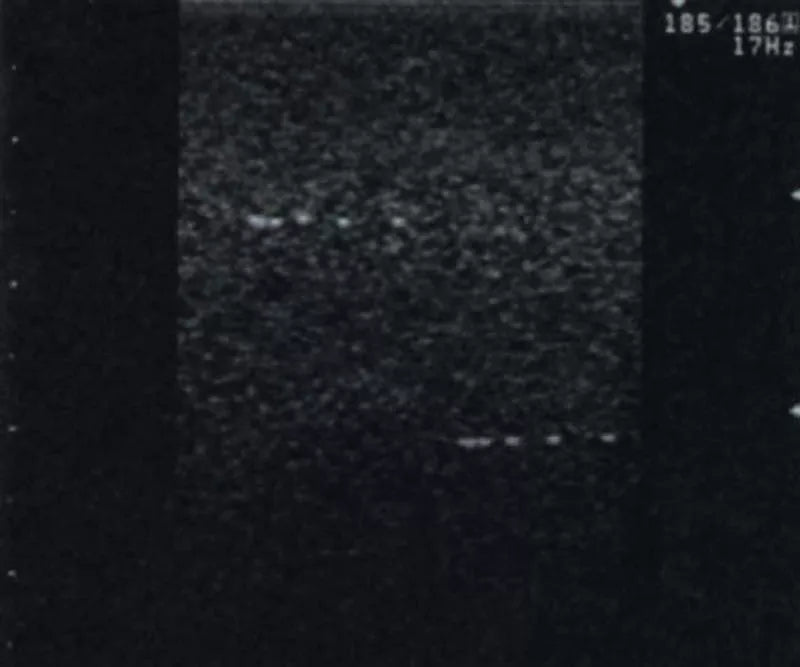 Erler-Zimmer Vielzweck-Phantom