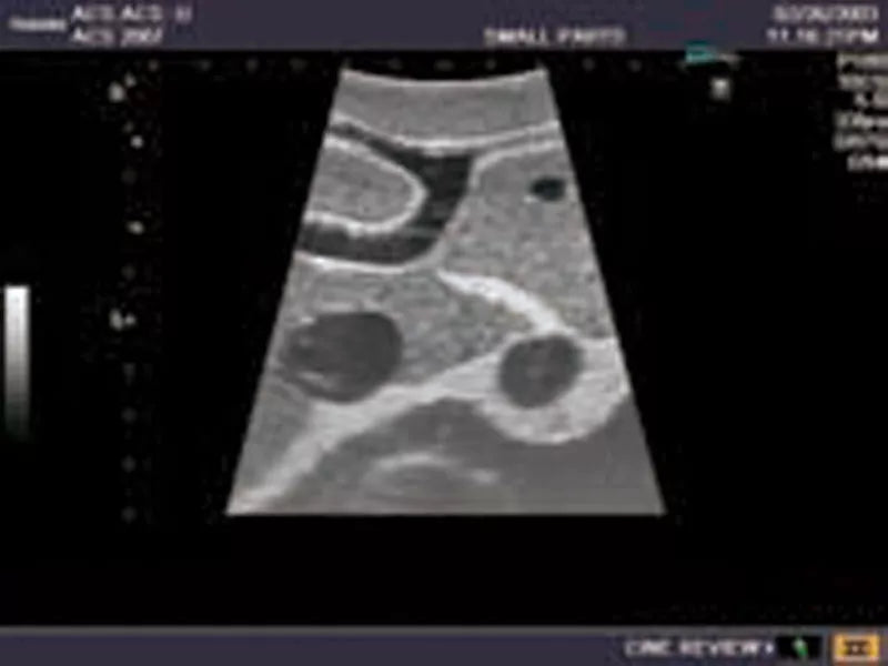 Erler-Zimmer Ultraschall-Modell für Sonografie