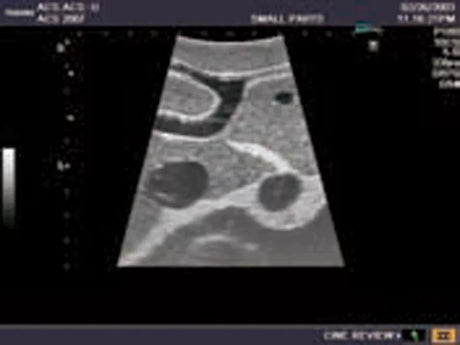 Erler-Zimmer Ultraschall-Modell für Sonografie