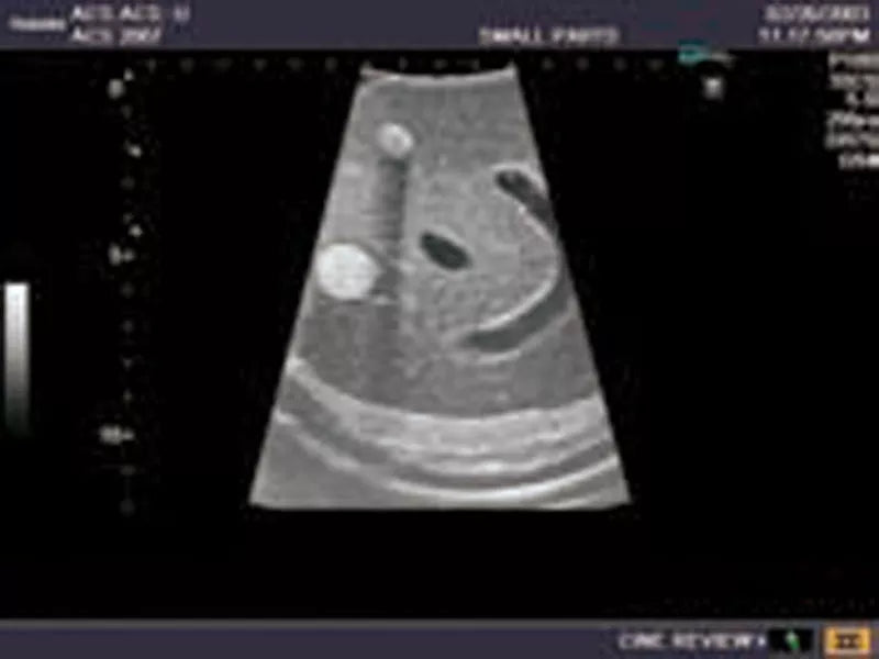 Erler-Zimmer Ultraschall-Modell für Sonografie