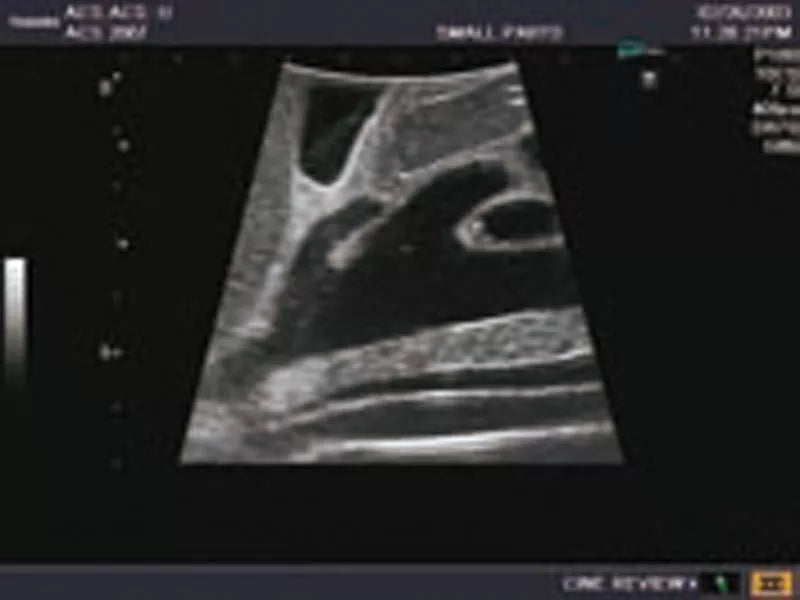 Erler-Zimmer Ultraschall-Modell für Sonografie
