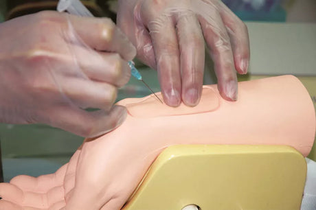 Erler-Zimmer Handgelenk zur Arterienpunktion