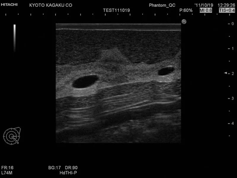 Erler-Zimmer Ultraschalluntersuchungsphantom-Brust