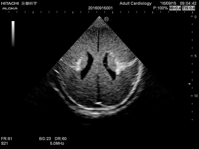 Erler-Zimmer Neonatales Ultraschall-Übungsphantom Kopf