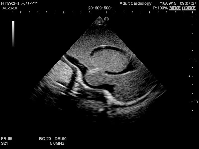 Erler-Zimmer Neonatales Ultraschall-Übungsphantom Kopf