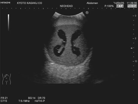 Erler-Zimmer Neonatales Ultraschall-Übungsphantom Kopf mit Hydrocephalus