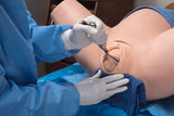 Erler-Zimmer Super OB Susie