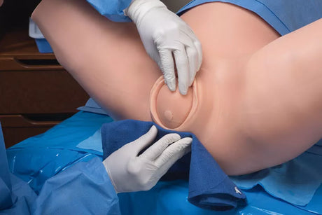 Erler-Zimmer Super OB Susie