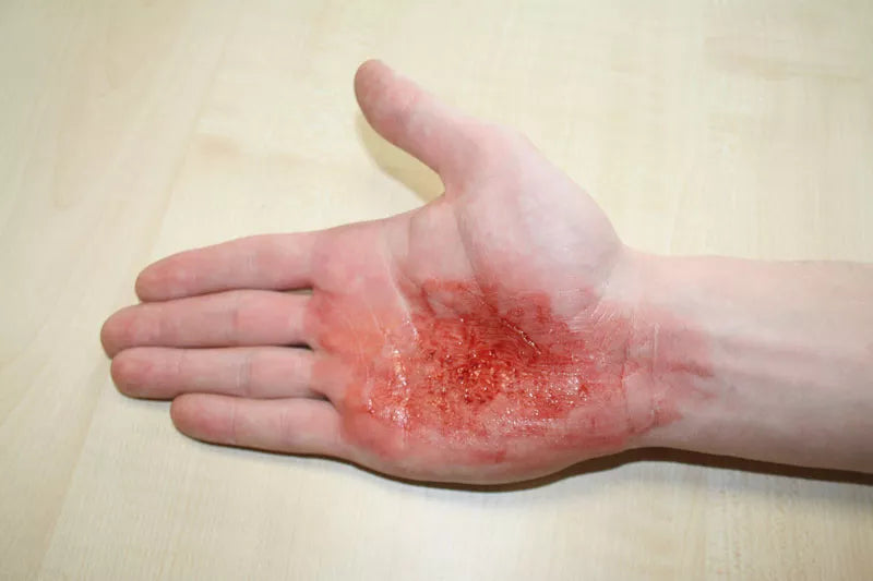 Erler-Zimmer EZ Wounds – Wundensimulation Basic