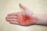 Erler-Zimmer EZ Wounds – Wundensimulation Basic