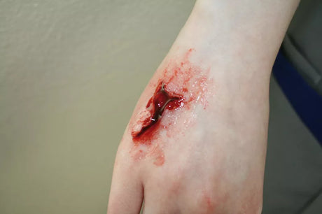 Erler-Zimmer EZ Wounds – Wundensimulation Basic