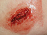 Erler-Zimmer EZ Wounds – Wundensimulation Basic