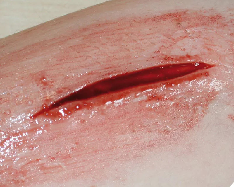 Erler-Zimmer EZ Wounds – Wundensimulation Basic