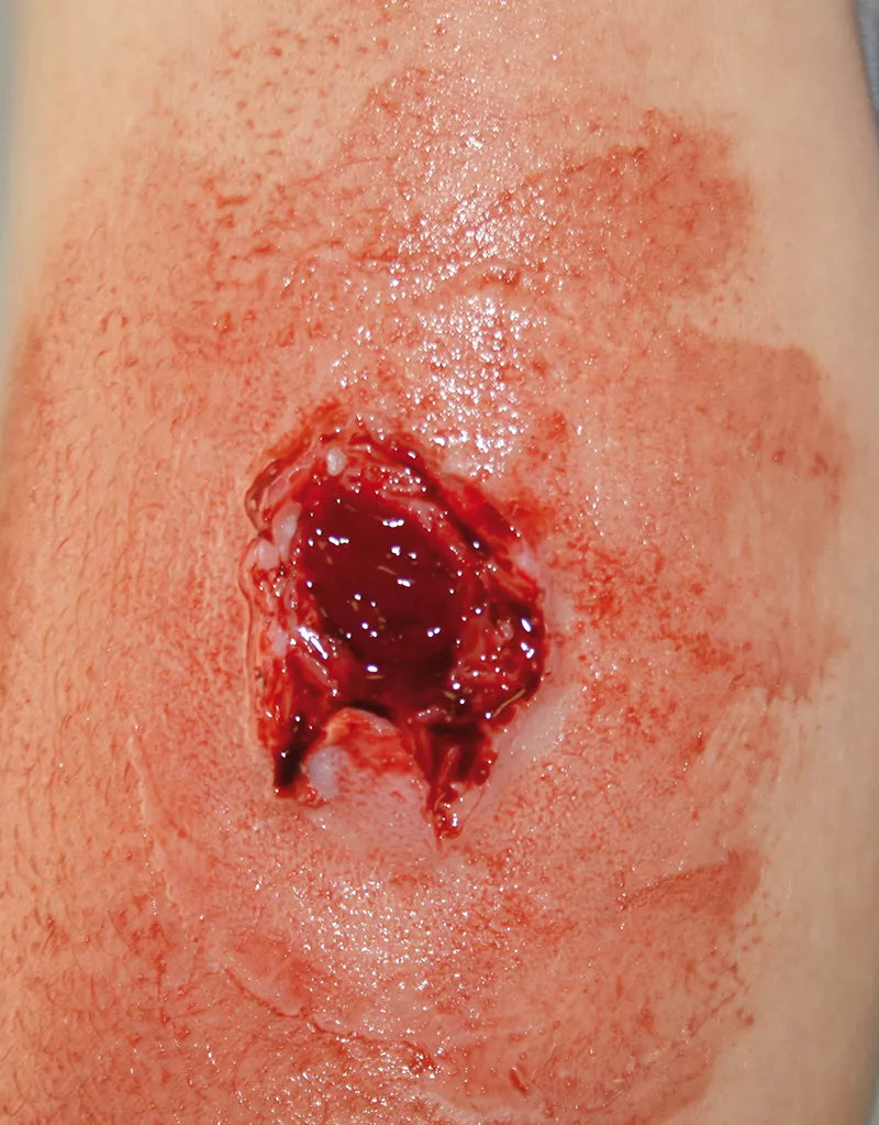 Erler-Zimmer EZ Wounds Wundensimulationsset „Professional“