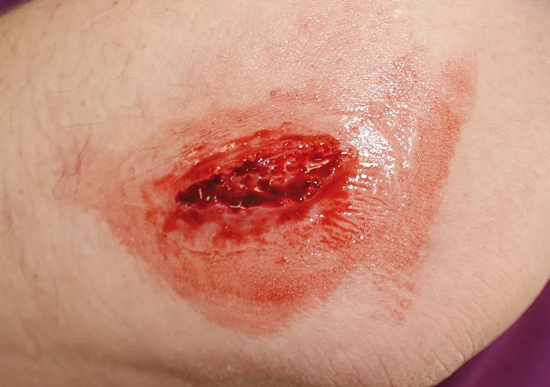 Erler-Zimmer EZ Wounds Wundensimulationsset „Professional“