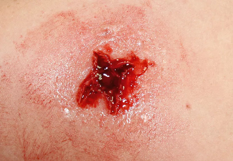Erler-Zimmer EZ Wounds Wundensimulationsset „Professional“