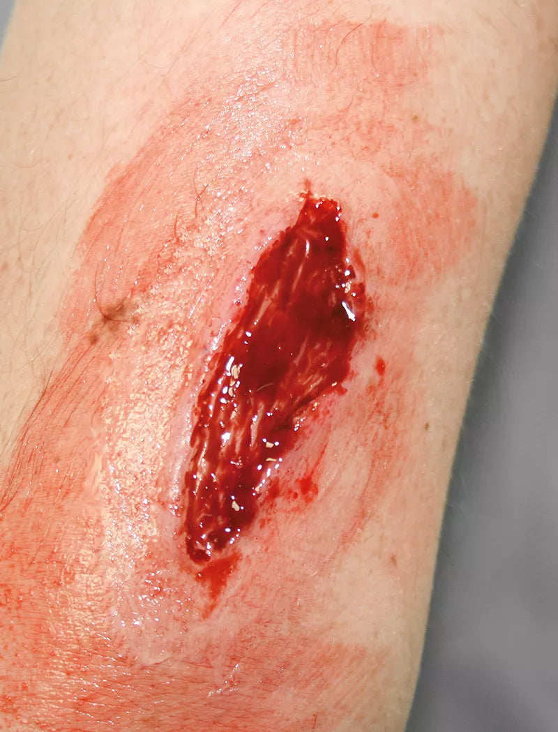 Erler-Zimmer EZ Wounds Wundensimulationsset „Professional“