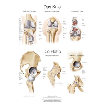 Erler-Zimmer Anatomische Lehrtafel "Das Knie / Die...