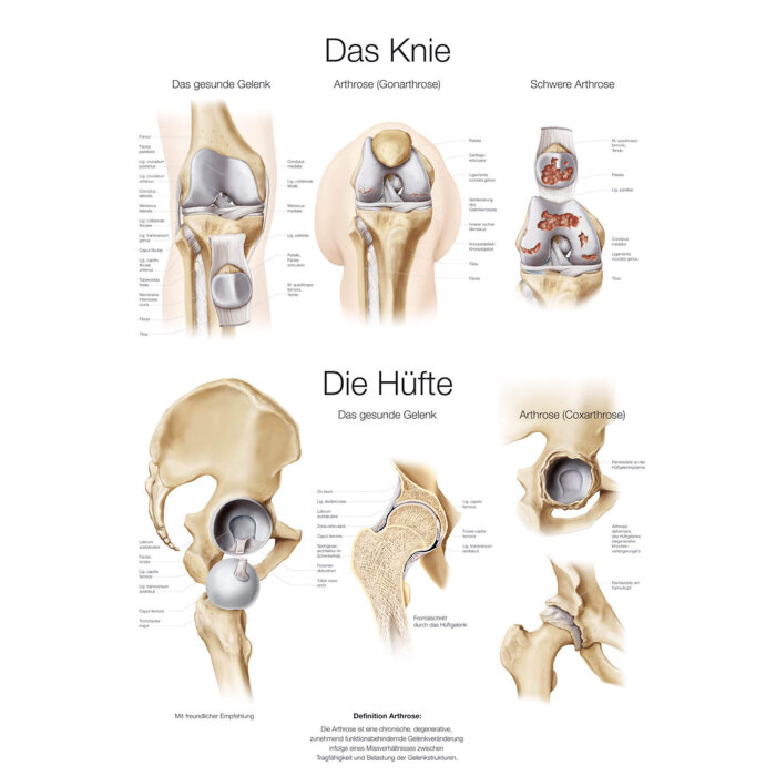 Erler-Zimmer Anatomische Lehrtafel "Das Knie / Die Hüfte" 50 x 70 cm