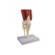 Erler-Zimmer Anatomisches Kniegelenkmodell mit Muskulatur