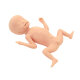Erler-Zimmer Frühgeborenes mit extrem niedrigem Geburtsgewicht (ELBW)